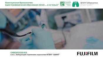 Вебинар с онлайн-трансляцией из операционной «Навигационная бронхоскопия: ищем периферические образования легких… и не только»